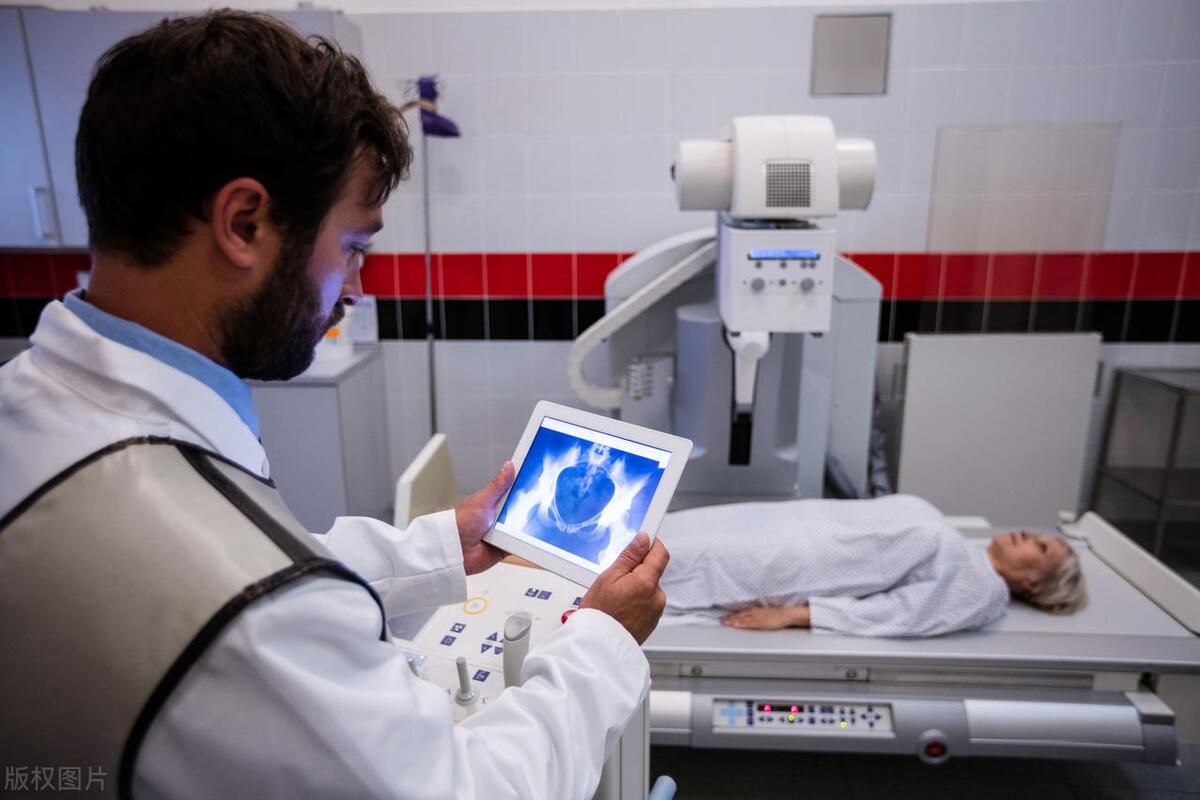 宫颈癌医疗纠纷,放疗医疗纠纷案例