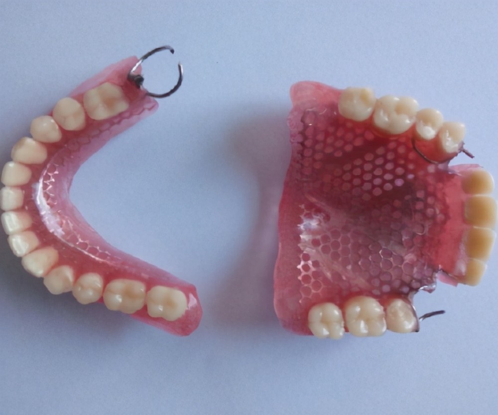 假牙怎么选最好,怎么判断自己的假牙是什么材质的