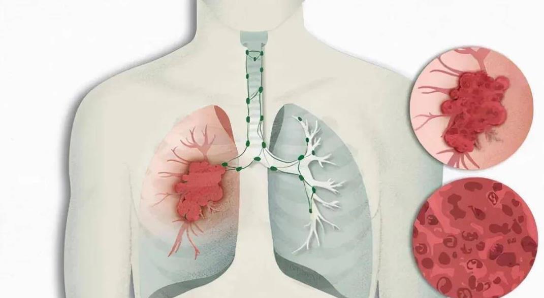 精神科医生和心理咨询师,如果你有问题去找心理医生