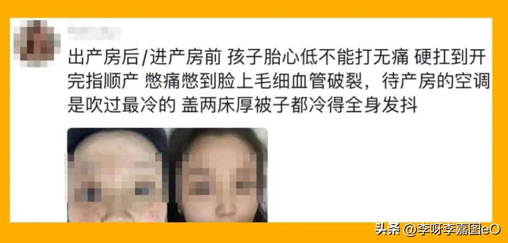 产妇拍下产床抓痕引20万妈妈共鸣:“生孩子我至今想起都心颤”