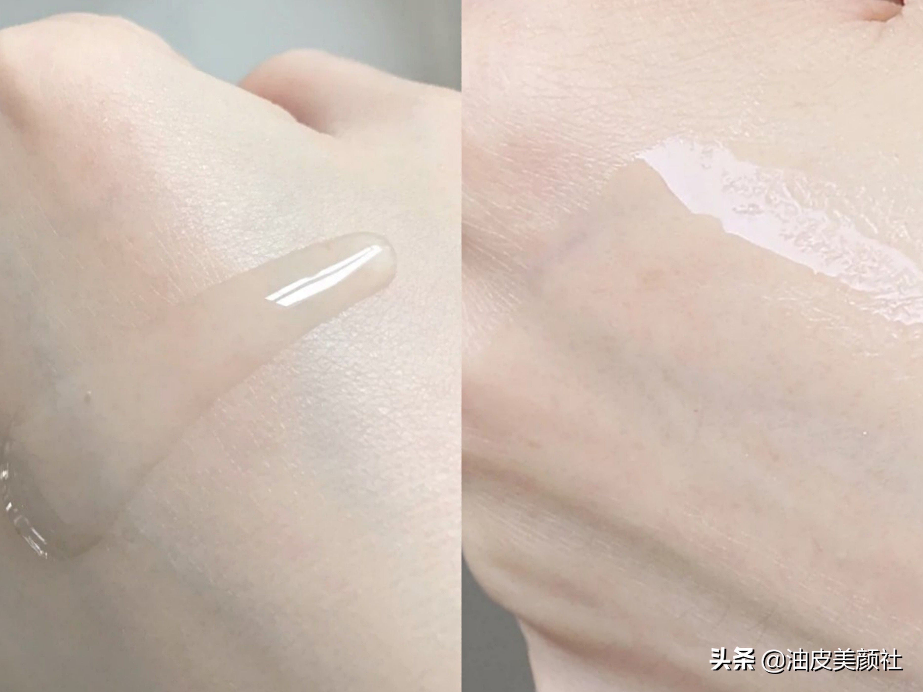 最让你惊为天人的美白精华有哪些？