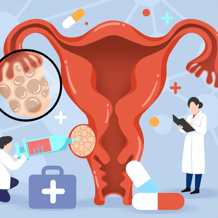 纵隔子宫对怀孕有影响吗,纵隔子宫需要治疗吗