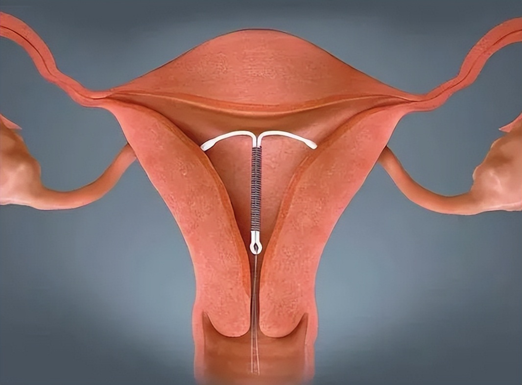 为什么男人不喜欢戴首饰,为什么男人都不喜欢戴戒指