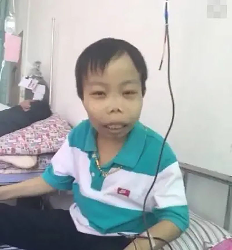 农村娃陈山,最丑网红陈山现状