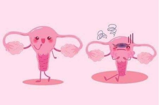 子宫内膜异位怀孕后有什么症状,内膜异位到直肠上是什么症状