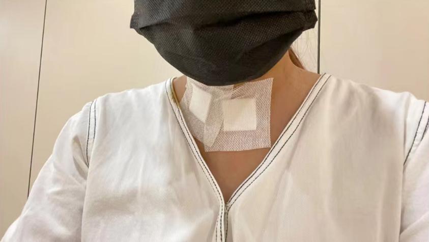 案例分享:36岁确诊甲状腺癌,从发现到治疗全过程