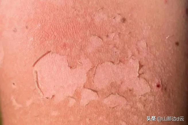 想活得倍有面子,想活得越来越年轻