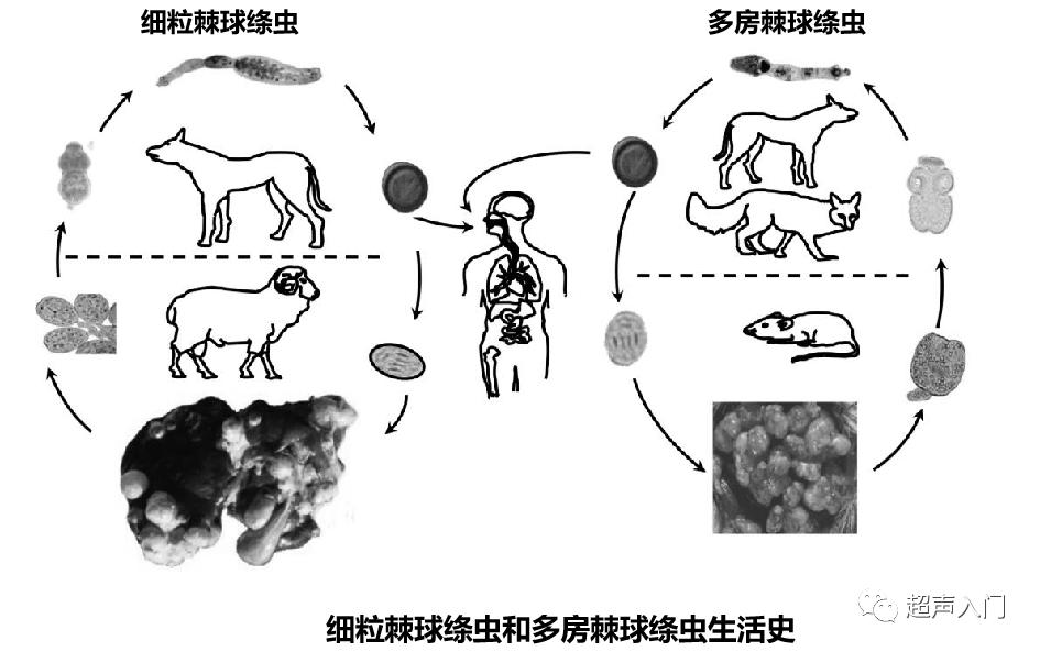 肝包虫病b超能检查出来吗,肝纤维化b超能检查出来吗