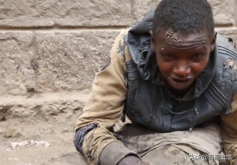 非洲男孩每天喝“胶水”,终日与蚊子相伴,被人称为“僵尸男孩”