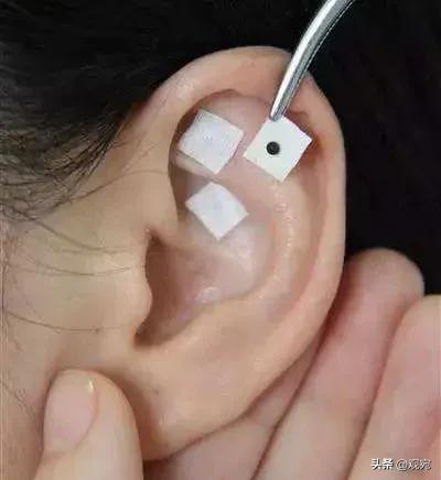 耳穴贴膏的功效,耳穴贴膏疗法
