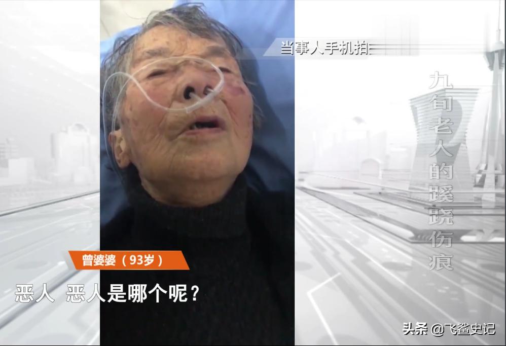 母亲被火灾烧伤,母亲被火烧死后续