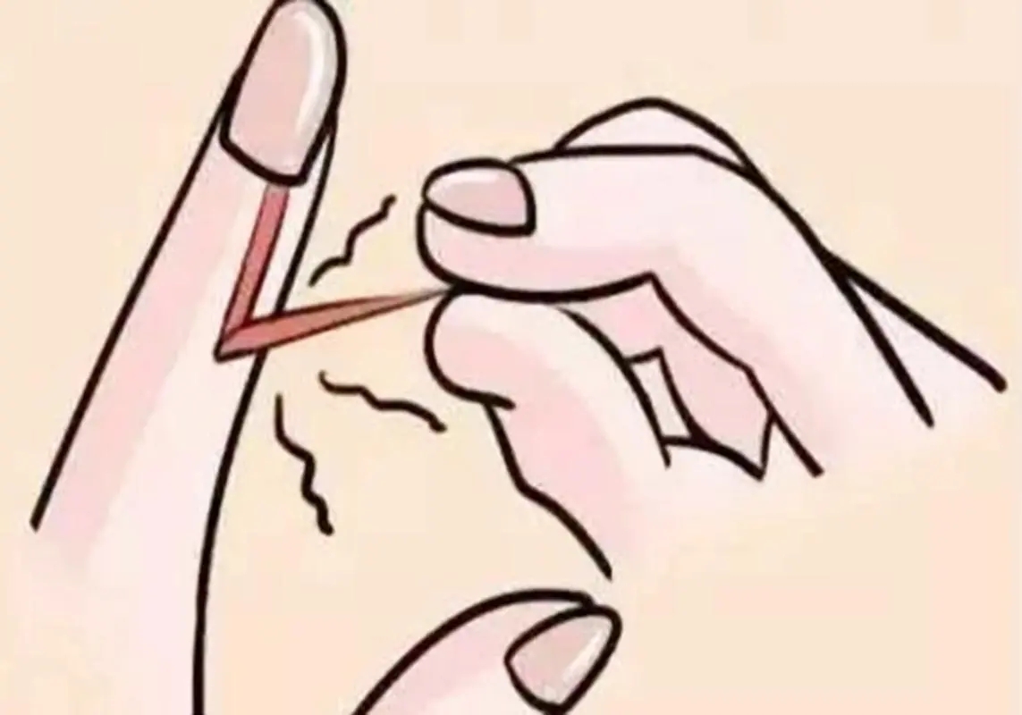 长倒刺是缺什么应该怎么吃,长倒刺缺什么营养