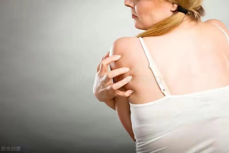 湿疹为什么特别痒,湿疹痒但没有小水泡是不是湿疹