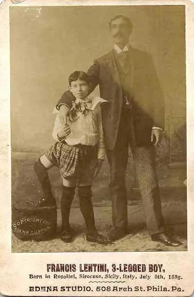 弗兰克伦蒂尼,弗兰克三条腿