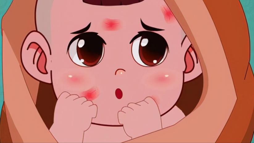 孩子身上的胎记是血管瘤吗,儿童面部红斑胎记