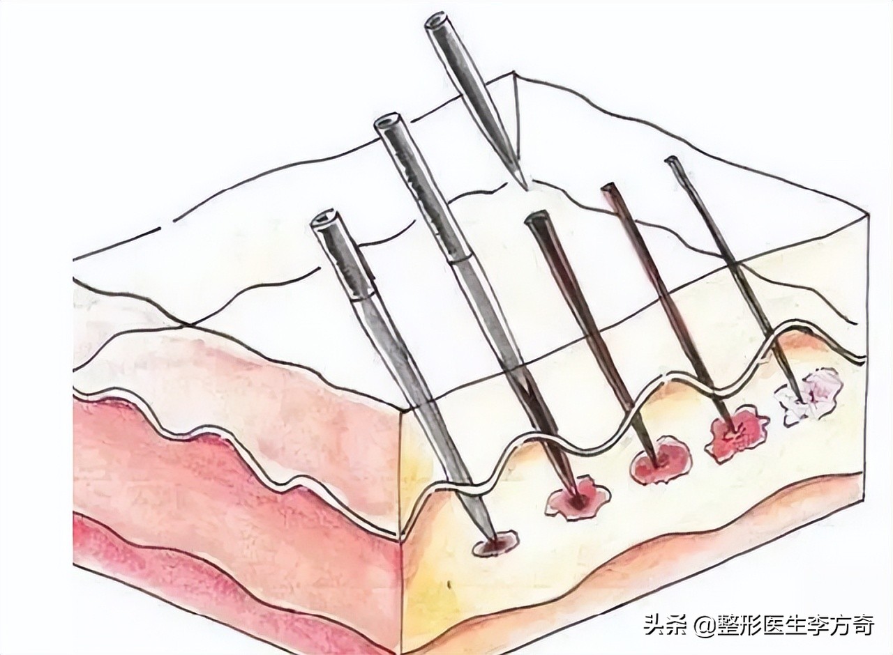 长期做医美真的可以改善皮肤吗,医生做医美免费吗
