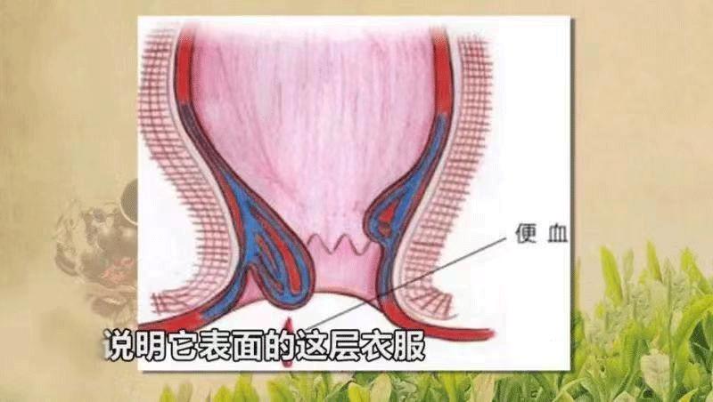 慢性肝损伤怎么引起消化系统疾病,疾病都是不良习惯造成的吗