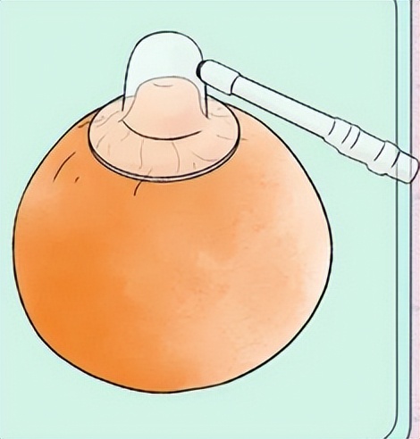 女生胸部上长了白色小点点,女生胸部长了好多小红点疙瘩