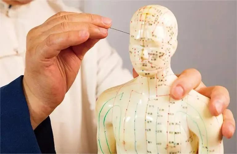 针灸治疗斑秃、乳房胀痛、斑秃、甲状腺结节、贝尔麻痹