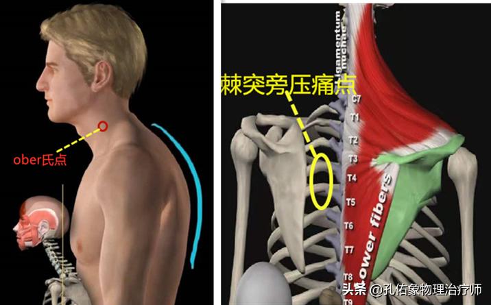 肩膀总是处于紧张状态怎么治疗,跑步肩膀僵硬怎么放松