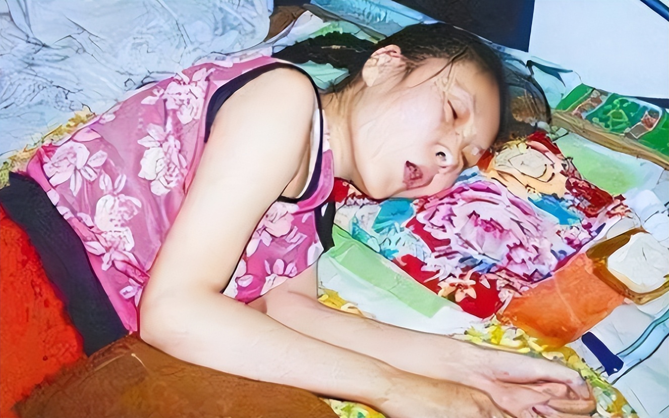 河北女孩瘫痪,河北女子瘫痪在床20年