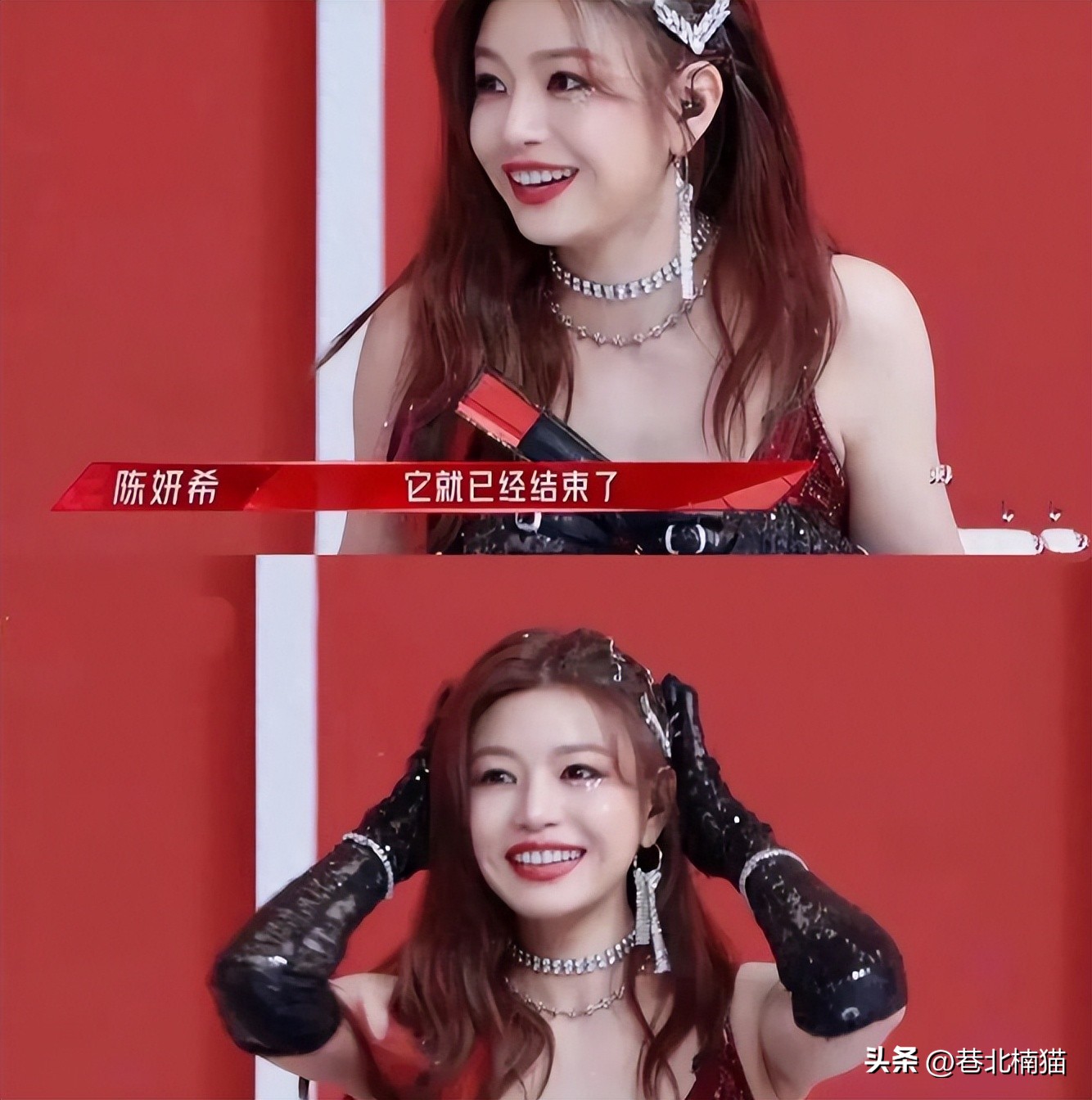 明星嘴突戴牙套前后对比,明星和假牙