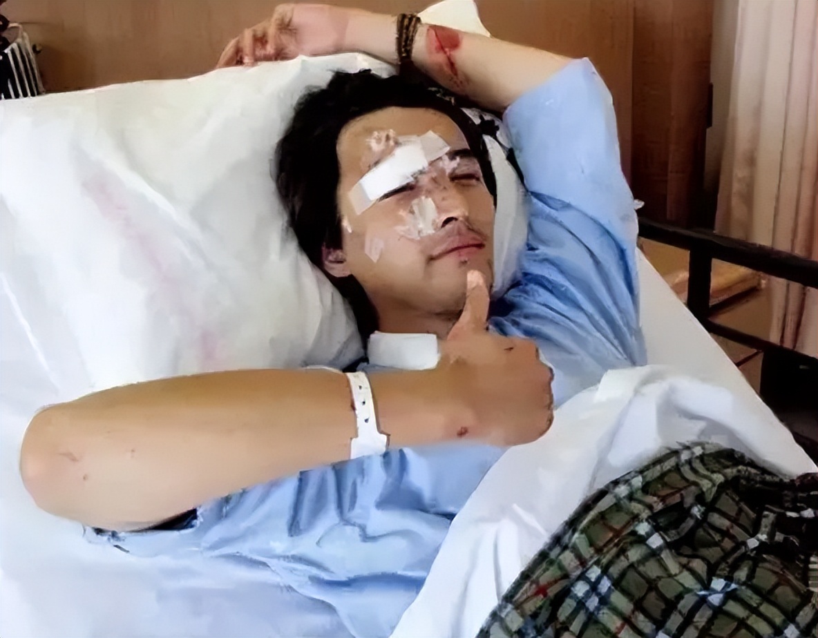 车祸后如何评价胡歌,胡歌车祸前后差别大吗