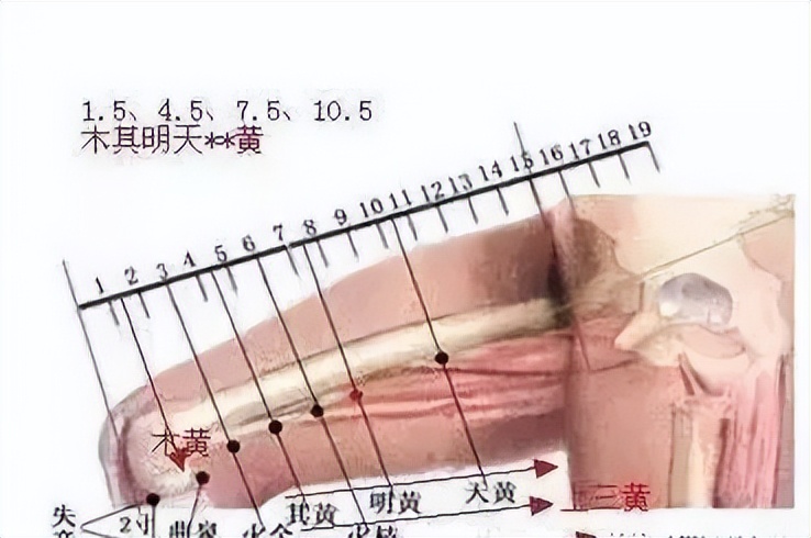 中医针灸小儿疾病处方1