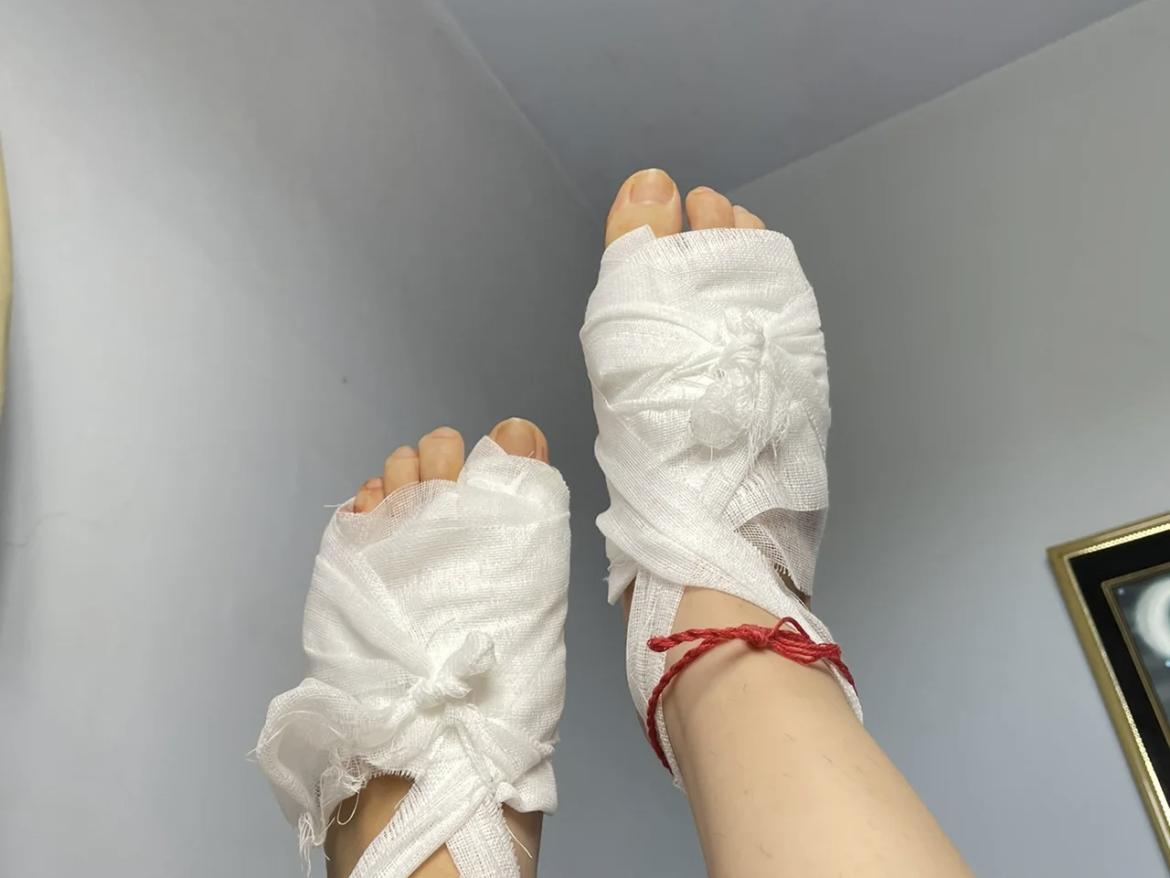 董小姐和老公吵架完整版,拇外翻手术辽宁女孩