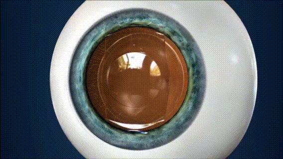 邹平爱尔眼科医院近视手术,邹平爱尔眼科医院优惠