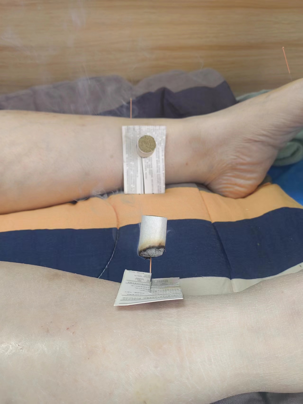 倪海厦针灸治疗下腹坠胀,中医女性下腹部针灸视频