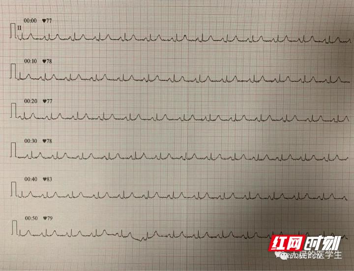 张家界医院可以做手术吗,张家界人民医院可以做激光手术吗