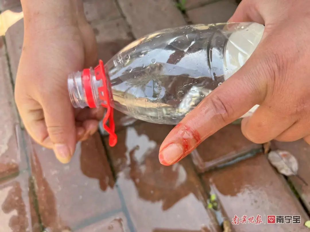 群众不小心被蛇咬伤,在山上被蛇咬伤后紧急处理办法