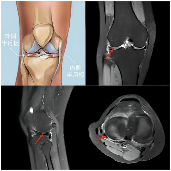 健康小知识运动损伤的常见症状,运动损伤知识科普宣传内容