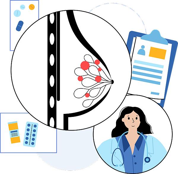 9个月长乳腺结节了严重吗,九个月乳房硬块