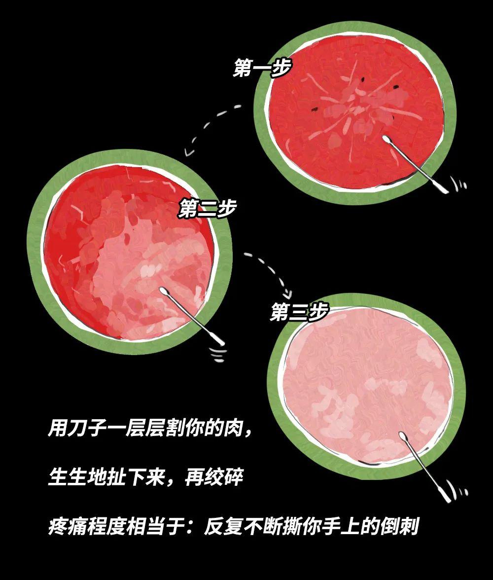 官宣:是的,我流产过