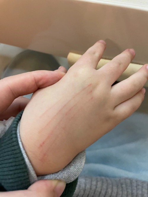 小叶医探,儿童长的恒牙是锯齿状的