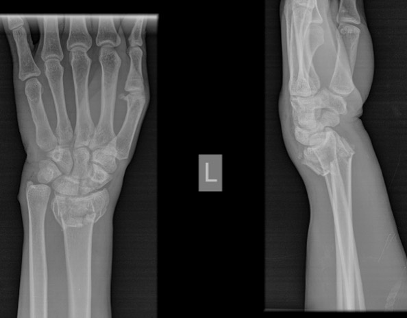 武汉骨科医生抵达首日患者就“找上门”，中医正骨手法技惊莱索托